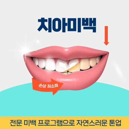 양주치과 양주시 치과 치아미백